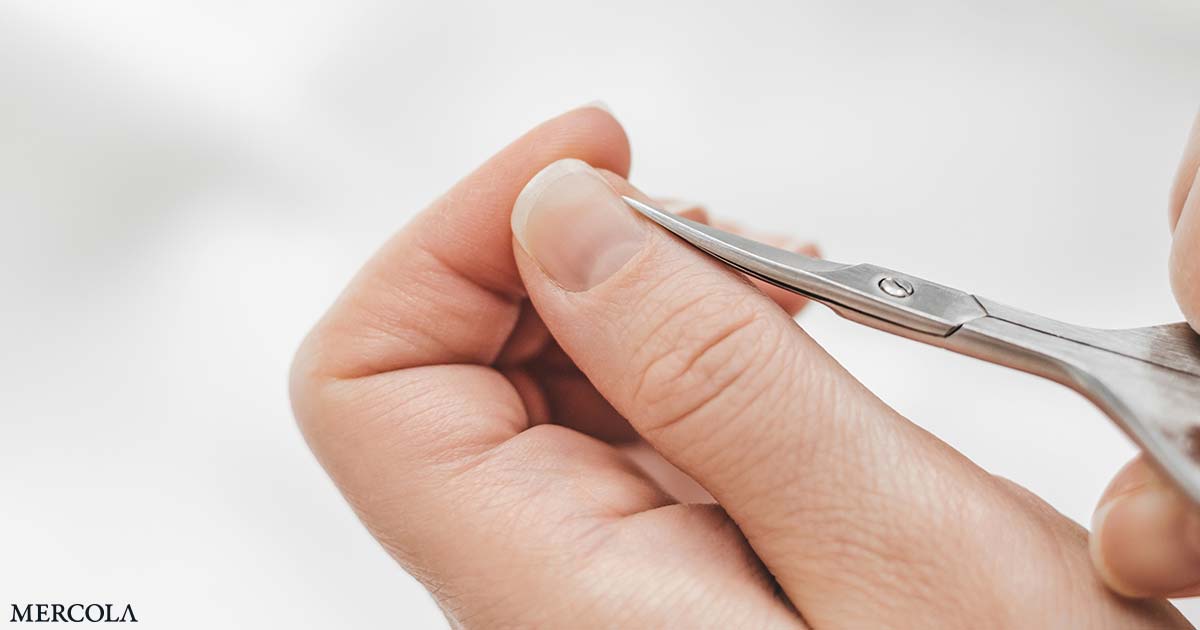 Find out how to Deal with Hangnails (and Cease Them from Coming Again)