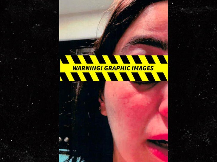 Columbus Short’s Wife Claims He’s Abusing Her, Shares Alleged Injury Photos