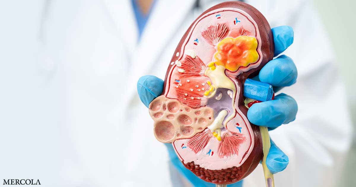 Types of Medications That Harm Your Kidneys