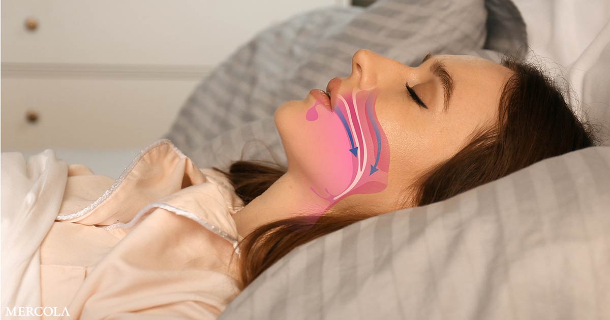 How Sleep Apnea Quietly Destroys Your Memory