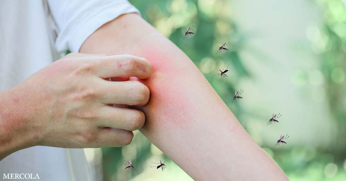 What Makes Mosquitoes More Likely to Bite You