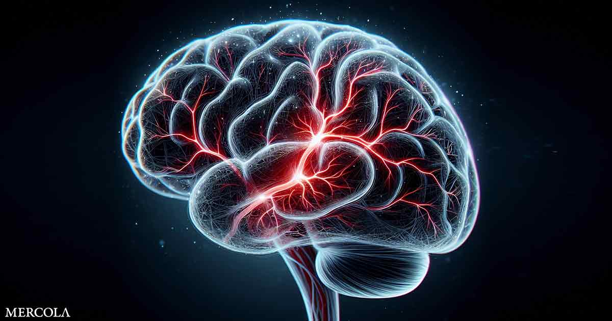 A Ministroke Has Major Consequences