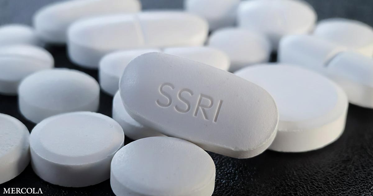 Antidepressants (SSRI) Trigger Hyponatremia, Which Causes Severe Anxiety