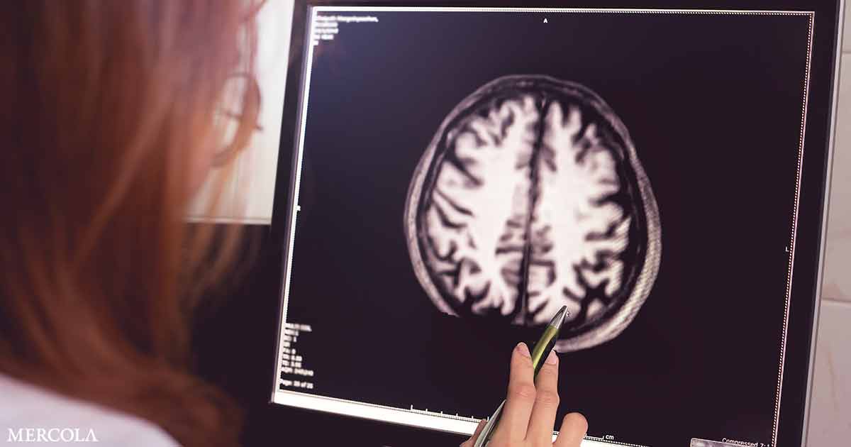 Researchers Make a Major Breakthrough in Predicting Neurodegenerative Diseases