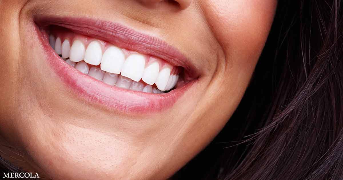 Gum Disease and Cavities Strongly Linked to Higher Stroke Risk