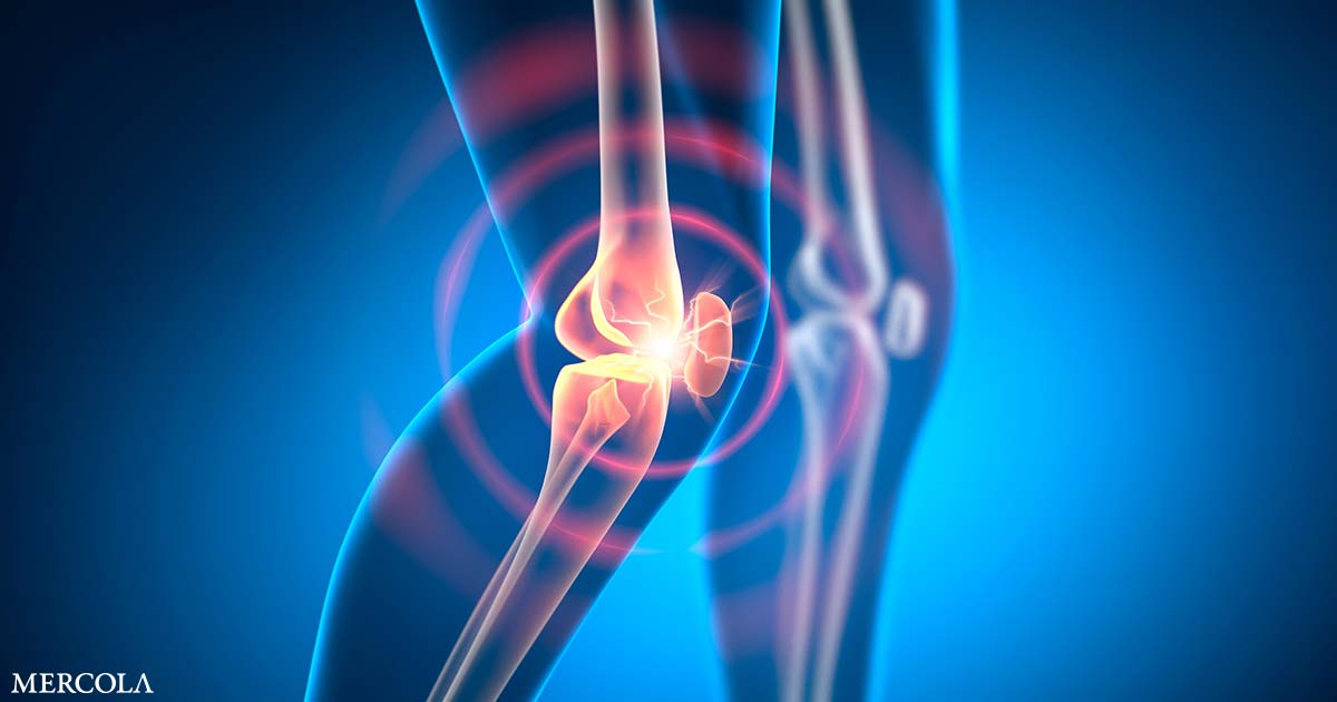 Study Finds Surprising Differences in Knee Injuries Between Men and Women