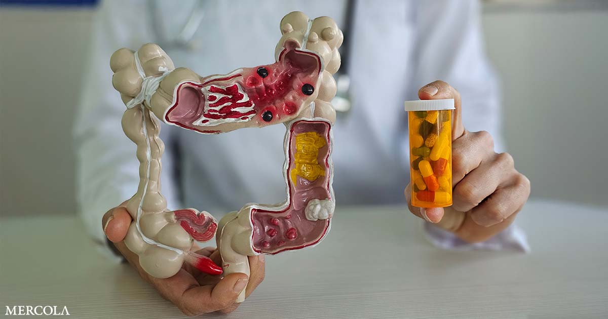 Common Medications Can Disrupt Your Gut Health for Years
