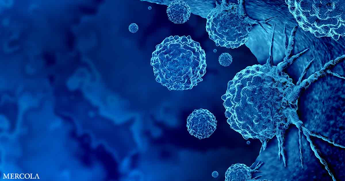 How Metabolic Health and Inflammation Influence Cancer Risk