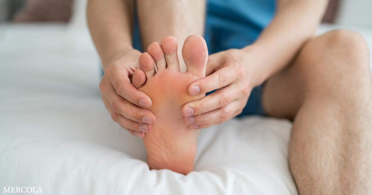 How to Eliminate Athlete’s Foot Naturally and Keep It from Returning