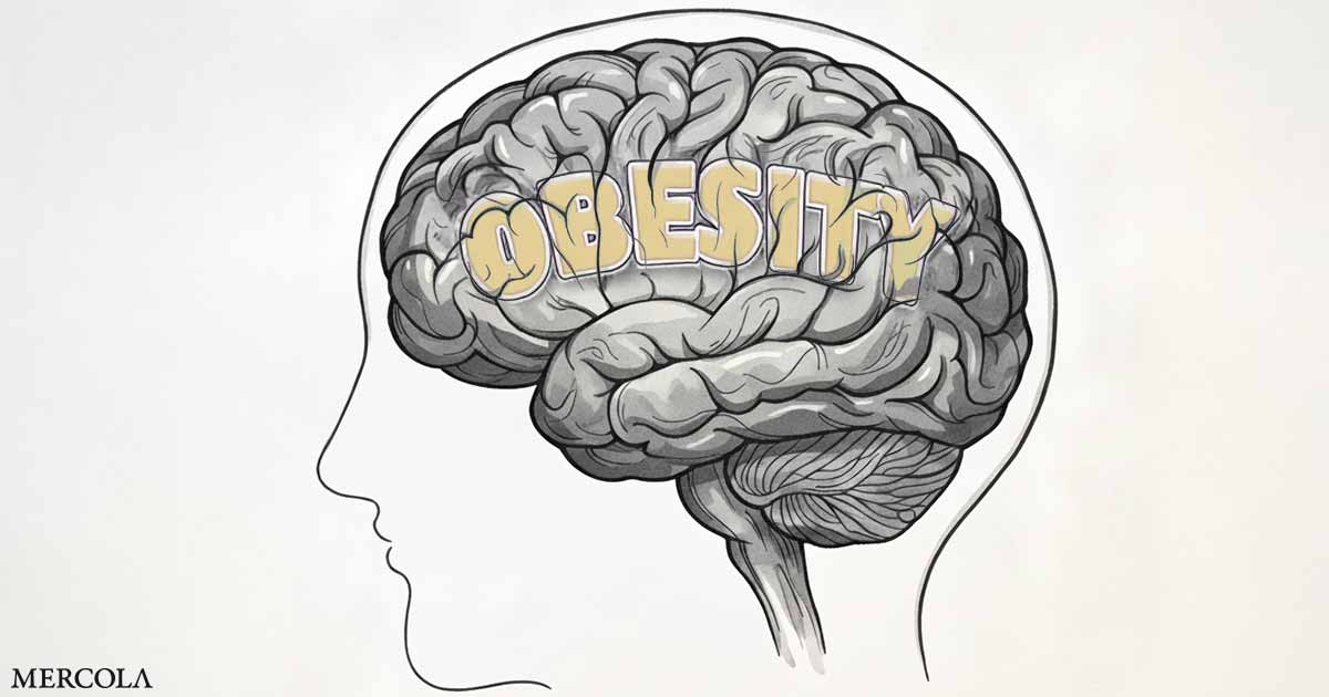 Obesity Drives Alzheimer's Through Fat Vesicles and Leptin